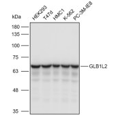 Solarbio K110920P Anti-GLB1L2 Polyclonal Antibody