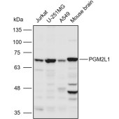 Solarbio K110967P Anti-PGM2L1 Polyclonal Antibody
