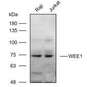 Solarbio K111057P Anti-FOXO3  Polyclonal Antibody
