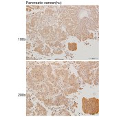 Solarbio K111232P Anti-PSPH Polyclonal Antibody