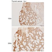 Solarbio K111238P Anti-TPI1 Polyclonal Antibody