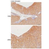 Solarbio K111289P Anti-PLG (heavy chain A short form, Cleaved-Val 98) Polyclonal Antibody