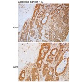 Solarbio K111801P Anti-IL23A Polyclonal Antibody