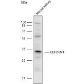 Solarbio K110613P Anti-EEF2KMT Polyclonal Antibody