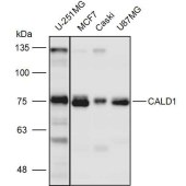 Solarbio K111295P Anti-CALD1 Polyclonal Antibody