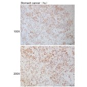 Solarbio K110919P Anti-MCM7 Polyclonal Antibody