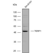 Solarbio K111047P Anti-TERF1 Polyclonal Antibody