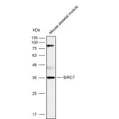 Solarbio K111985P Anti-BIRC7 Polyclonal Antibody