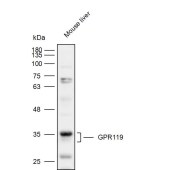 Solarbio K111858P Anti-GPR119 Polyclonal Antibody