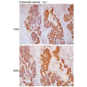 Solarbio K111745P Anti-RPS6 Polyclonal Antibody