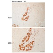 Solarbio K111024P Anti-PCBP1 Polyclonal Antibody