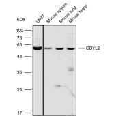 Solarbio K111751P Anti-CDYL2 Polyclonal Antibody