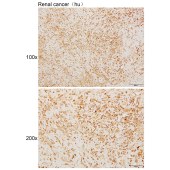 Solarbio K111433P Anti-GLIPR2 Polyclonal Antibody