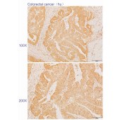 Solarbio K110569P Anti-ACYP2 Polyclonal Antibody