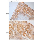 Solarbio K111802P Anti-PSME4 Polyclonal Antibody