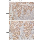 Solarbio K111601P Anti-CNNM3 Polyclonal Antibody