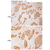 Solarbio K111708P Anti-GPANK1 Polyclonal Antibody