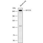 Solarbio K111913P Anti-MYO10 Polyclonal Antibody
