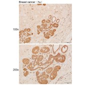 Solarbio K111905P Anti-CXADR Polyclonal Antibody