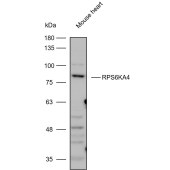 Solarbio K111077P Anti-RPS6KA4 Polyclonal Antibody