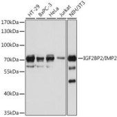 Solarbio K009911P Anti-IGF2BP2 Polyclonal Antibody