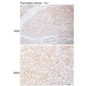 Solarbio K110922P Anti-RAD17 Polyclonal Antibody