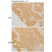 Solarbio K111422P Anti-TMEM156 Polyclonal Antibody