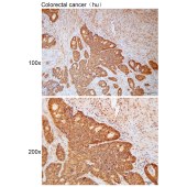 Solarbio K111807P Anti-ZDHHC20 Polyclonal Antibody