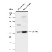 Solarbio K111984P Anti-GSTM5 Polyclonal Antibody