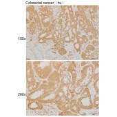 Solarbio K111886P Anti-IARS2 Polyclonal Antibody