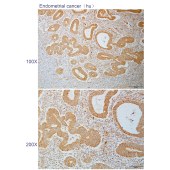 Solarbio K110840P Anti-RPS6KA6 Polyclonal Antibody