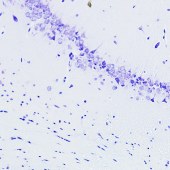 Solarbio G1701 焦油紫染色液(0.06%)