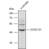 Solarbio K110984P Anti-CCDC121 Polyclonal Antibody