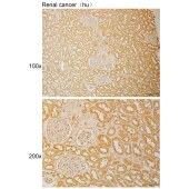 Solarbio K111027P Anti-PSMA2 Polyclonal Antibody
