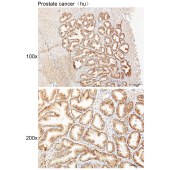 Solarbio K111454P Anti-SUDS3 Polyclonal Antibody