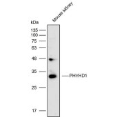 Solarbio K111729P Anti-PHYHD1 Polyclonal Antibody