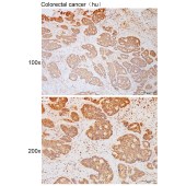 Solarbio K111789P Anti-NAA40 Polyclonal Antibody