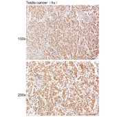 Solarbio K111435P Anti-CLIC2 Polyclonal Antibody
