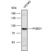 Solarbio K111126P Anti-PGBD1 Polyclonal Antibody