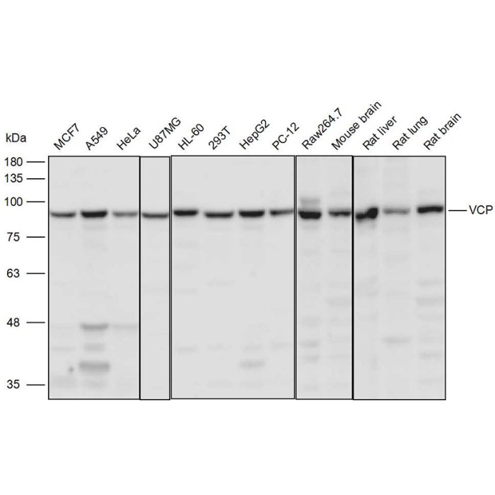 Solarbio K111488P Anti-VCP Polyclonal Antibody - 试剂仪器耗材