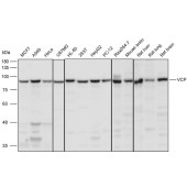 Solarbio K111488P Anti-VCP Polyclonal Antibody