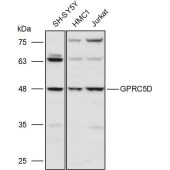 Solarbio K111260P Anti-GPRC5D Polyclonal Antibody