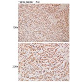 Solarbio K111950P Anti-ACTL7B Polyclonal Antibody