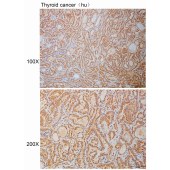 Solarbio K110927P Anti-TBC1D14 Polyclonal Antibody