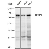 Solarbio K111948P Anti-RPAP1 Polyclonal Antibody