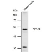 Solarbio K111000P Anti-KPNA5 Polyclonal Antibody