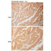 Solarbio K111053P Anti-ARSD Polyclonal Antibody