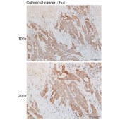 Solarbio K111951P Anti-MRPS31 Polyclonal Antibody