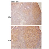 Solarbio K111039P Anti-KCNMA1 Polyclonal Antibody