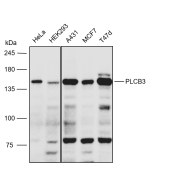 Solarbio K111637P Anti-PLCB3 Polyclonal Antibody